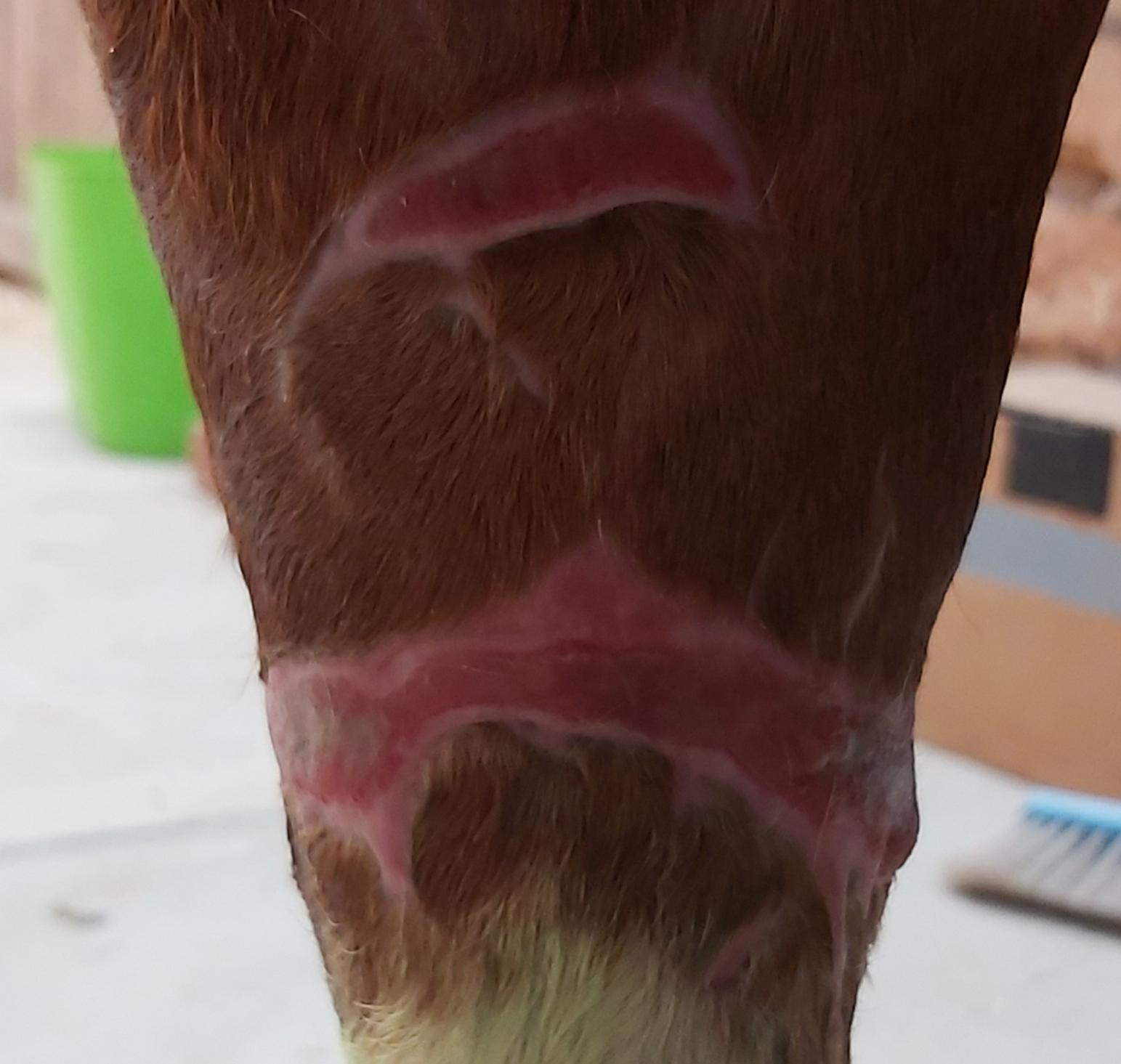 Shar's de-gloved leg - McDowell's Herbal Treatments