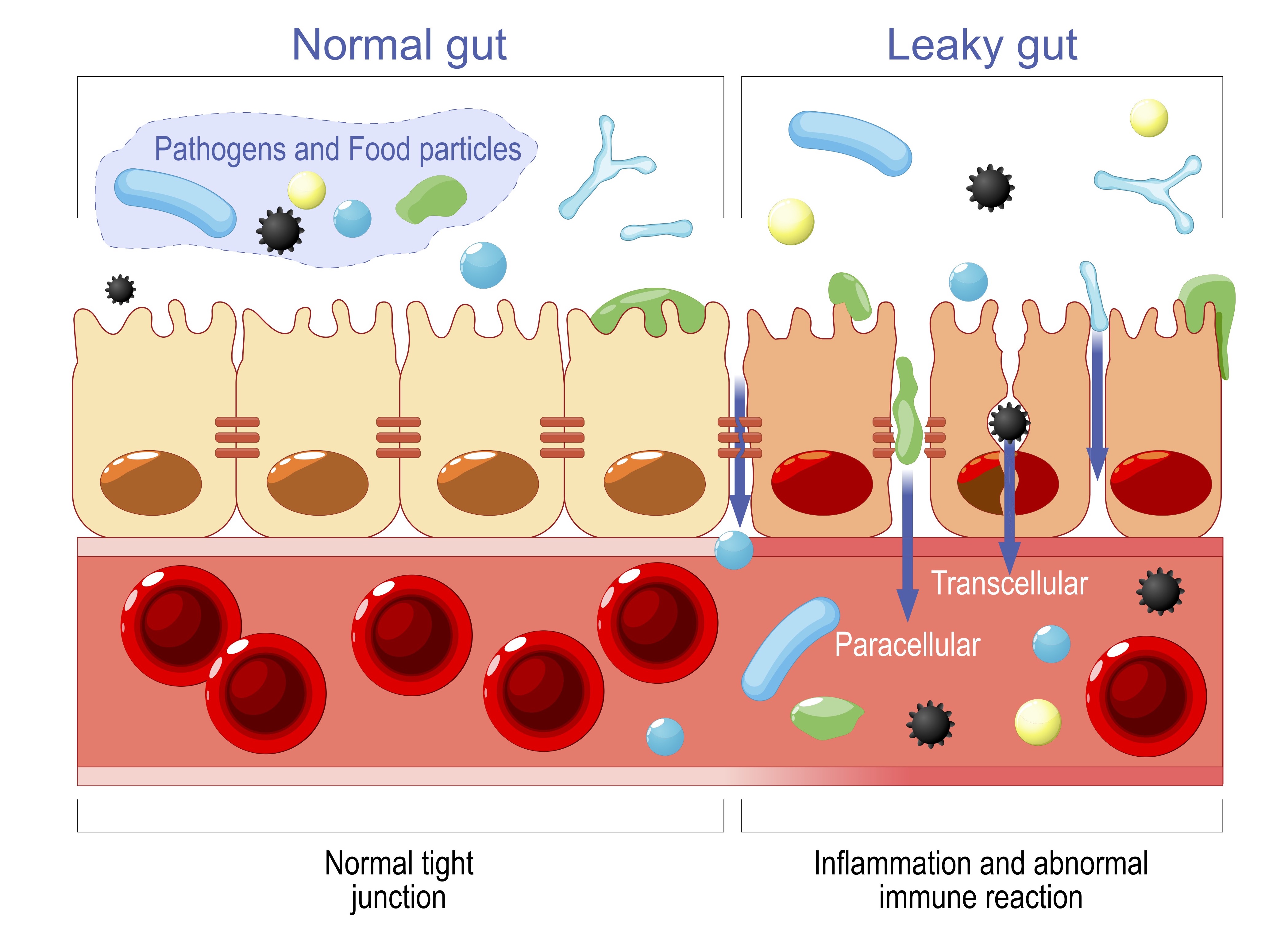 stock leakygut SML